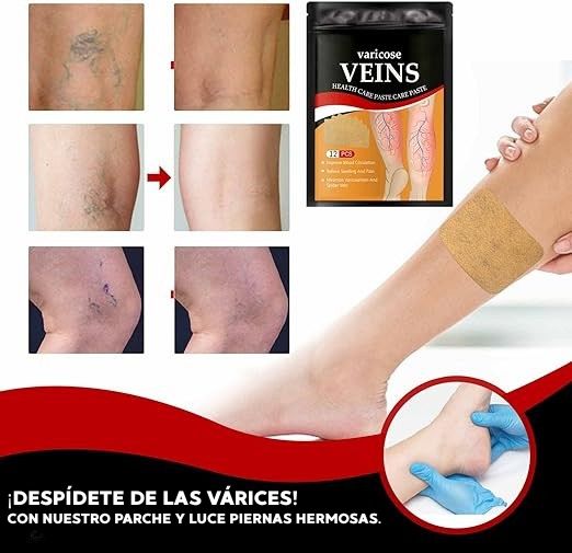 ¡DESPÍDETE DE LAS VÁRICES CON NUESTRO PARCHE INNOVADOR!