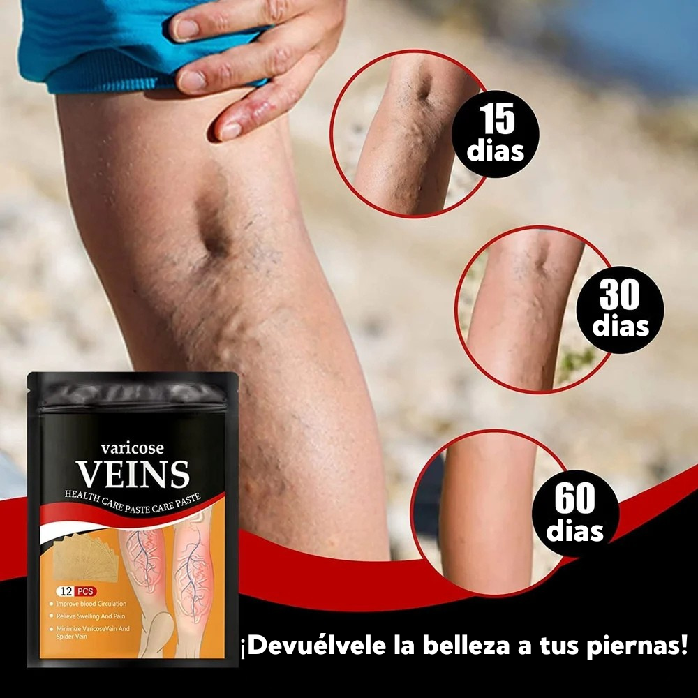 ¡DESPÍDETE DE LAS VÁRICES CON NUESTRO PARCHE INNOVADOR!
