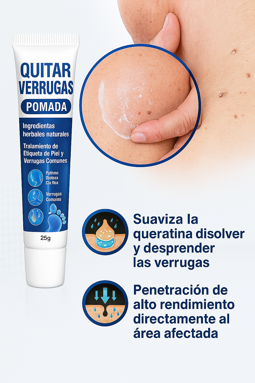 Crema antiverrugas ¡Elimina las Verrugas de Forma Rápida y Efectiva!